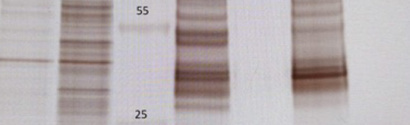 RNA-biology and metabolism in kidney disease