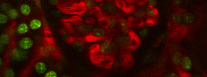 In vivo imaging of the mouse glomerulus