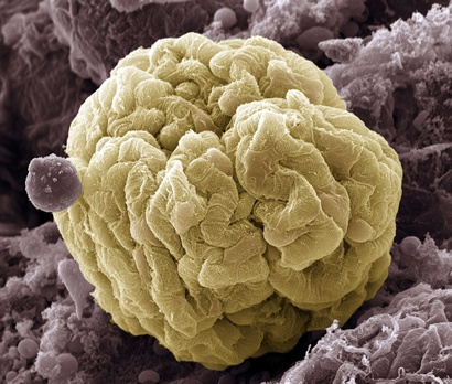 Deciphering the metabolome at the kidney filtration barrier