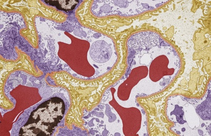 Crosstalk of podocytes with the endothelium