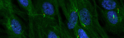 Cilia Biology and Cystic Kidney Disease